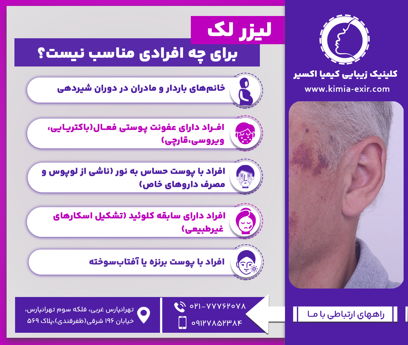 لیزر لک برای چه افرادی مناسب نیست؟
•	خانم‌های باردار و مادران در دوران شیردهی
•	افراد دارای عفونت‌ پوستی فعال (باکتریایی، ویروسی، قارچی)
•	افراد با پوست حساس به نور (ناشی از لوپوس و مصرف داروهای خاص)
•	افراد دارای سابقه کلوئید (تشکیل اسکارهای غیرطبیعی)
•	افراد با پوست برنزه یا آفتاب‌سوخته
