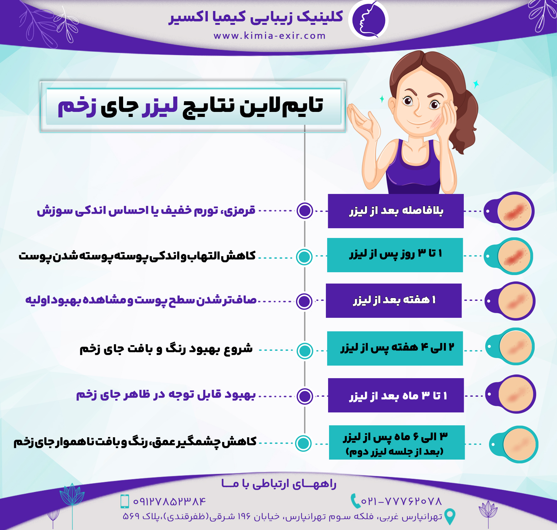 تایم‌لاین نتایج لیزر جای زخم
بلافاصله بعد از لیزر	قرمزی، تورم خفیف یا احساس اندکی سوزش
1 تا 3 روز پس از لیزر	کاهش التهاب و اندکی پوسته‌پوسته شدن پوست
1 هفته بعد از لیزر	صاف‌تر شدن سطح پوست و مشاهده بهبود اولیه
2 الی 4 هفته پس از لیزر	شروع بهبود رنگ و بافت جای زخم
1 تا 3 ماه بعد از لیزر	بهبود قابل توجه در ظاهر جای زخم
3 الی 6 ماه پس از لیزر (بعد از جلسه لیزر دوم)	کاهش چشمگیر عمق، رنگ و بافت ناهموار جای زخم
