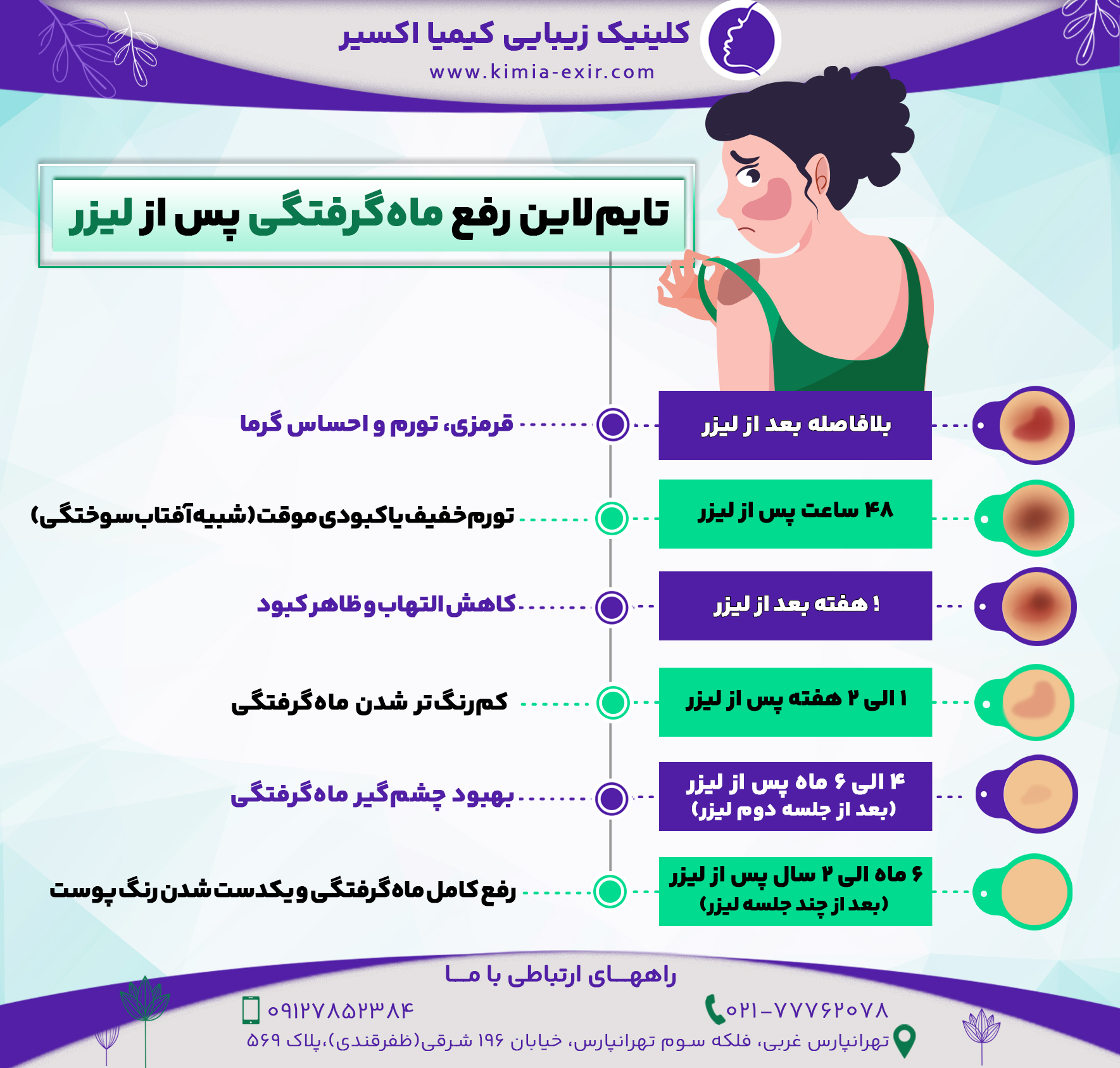 روش‌های رفع ماه گرفتگی صورت + درصد اثربخشی آن‌ها
1.	لیزر فرکشنال، کیوسوئیچ و ان‌دی + تا 70-95% اثربخشی
2.	جراحی ترمیمی پوست + 80-90% اثربخشی
3.	تزریق داروهای ترمیمی + 60-80% اثربخشی
4.	کرم‌های روشن‌کننده موضعی + 30-50% اثربخشی
5.	روش‌های خانگی + کمتر از 10% اثربخشی

