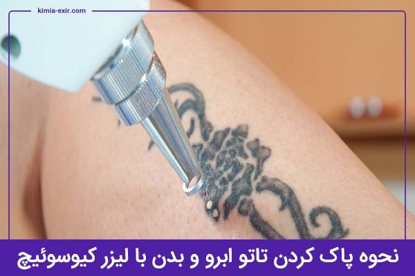 نحوه پاک كردن تاتو ابرو با لیزر کیوسوئیچ