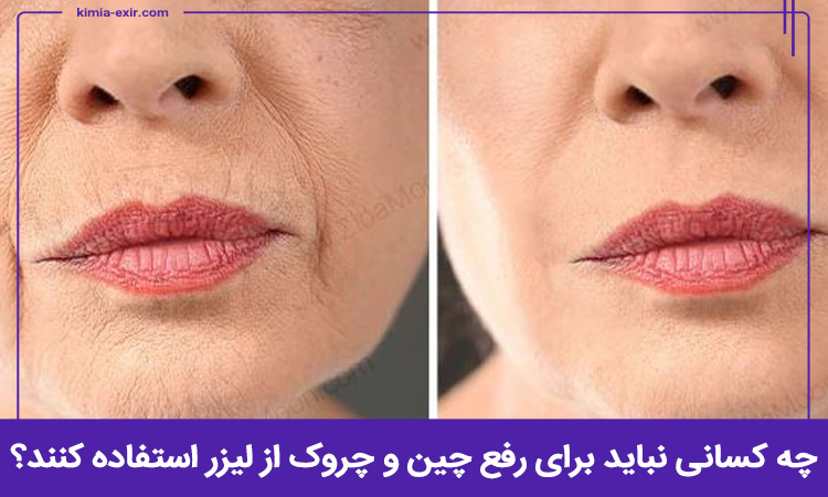 چه کسانی نباید برای رفع چین و چروک از لیزر استفاده کنند؟