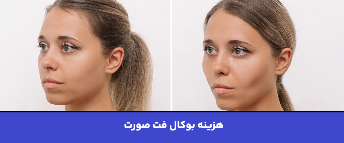 هزینه بوکال فت صورت