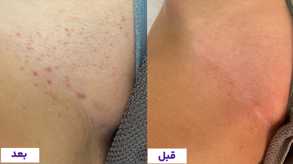 جوانسازی واژن بازسازی بافت و افزایش لطافت پوست ناحیه تناسلی در کیمیا اکسیر